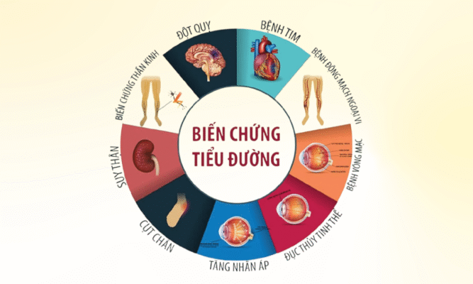 Biến chứng tiểu đường có thể xảy ra ở nhiều cơ quan trên cơ thể